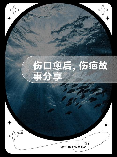 战争的创伤（一个士兵的故事）